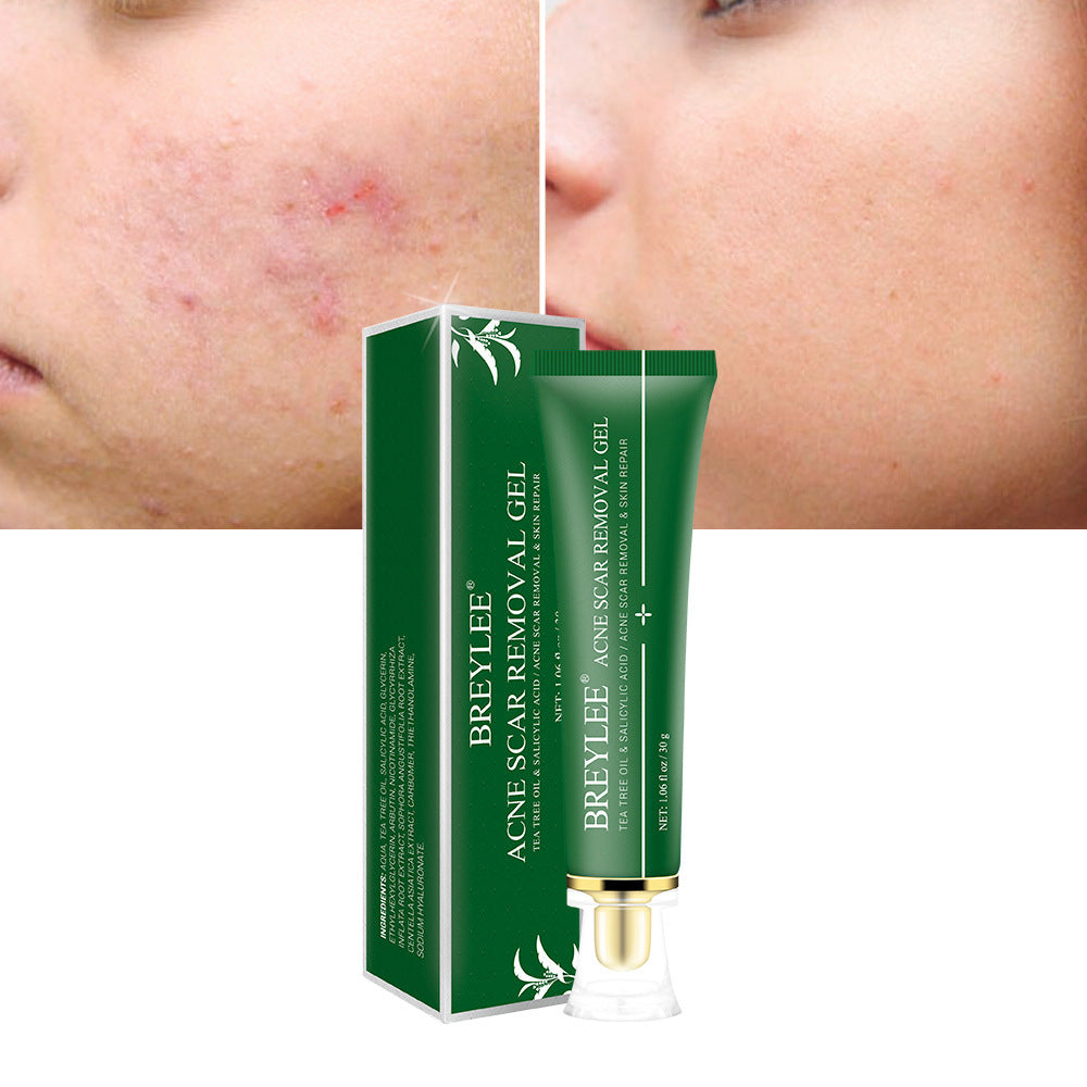 Acne Scar Removal Gel Tea - By BreyLee