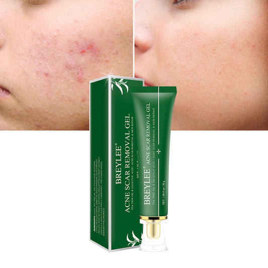 Acne Scar Removal Gel Tea - By BreyLee